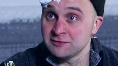 Клинический случай 04.11.2014