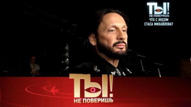 Стас Михайлов с болячкой на носу, ревнивец Владимир Пресняков, звездные мамы и приговор Аглае Тарасовой 28.11.2025